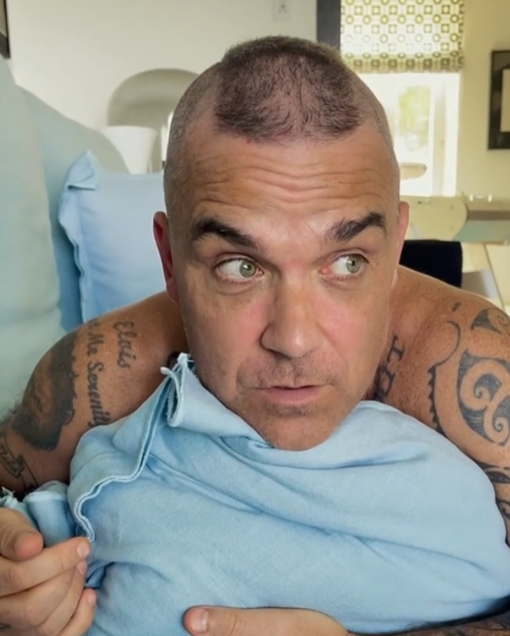 Robbie Williams přiznal, že mu řídnou vlasy