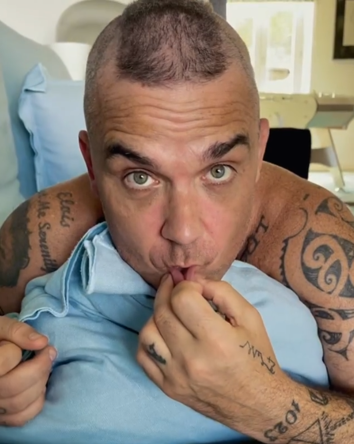 Robbie Williams přiznal, že mu řídnou vlasy