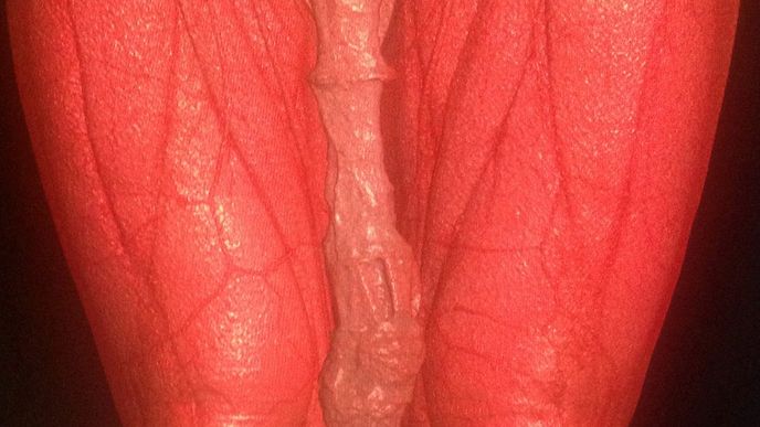 Velkou část Mexičanova penisu tvoří vytahaná předkožka.