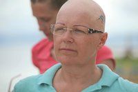 Blanka z Robinsonova ostrova trpí vážnou nemocí: Přišla o vlasy i obočí