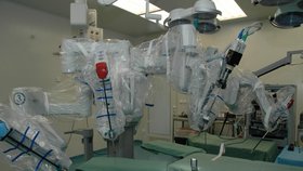 Robot se skládá ze čtyř ramen