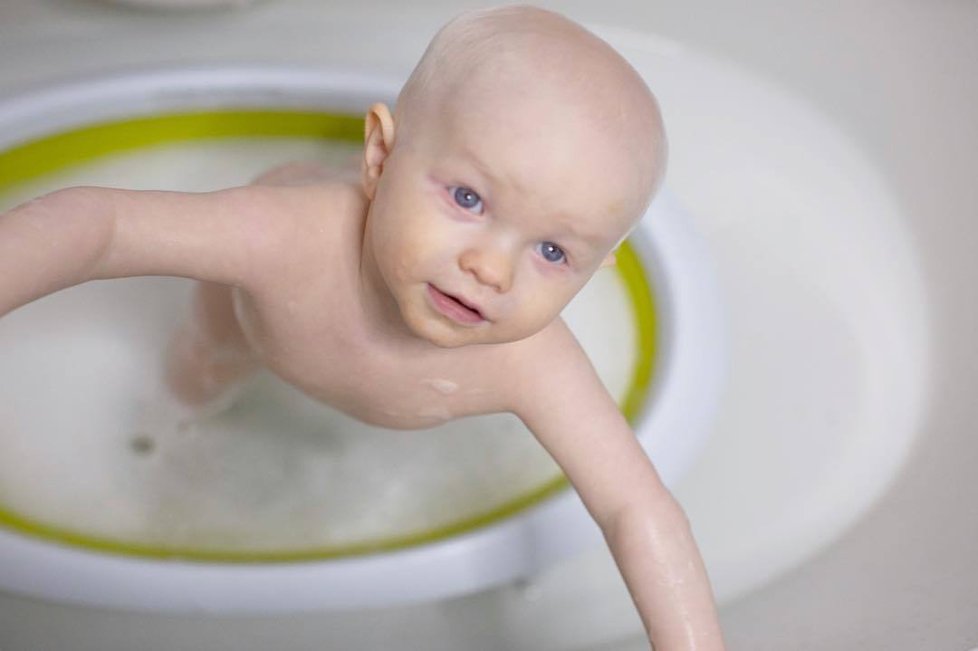 Nedávno se rozjela i kauza, kdy malý Rockwell, který je albín, se stal na internetu terčem posměchu.
