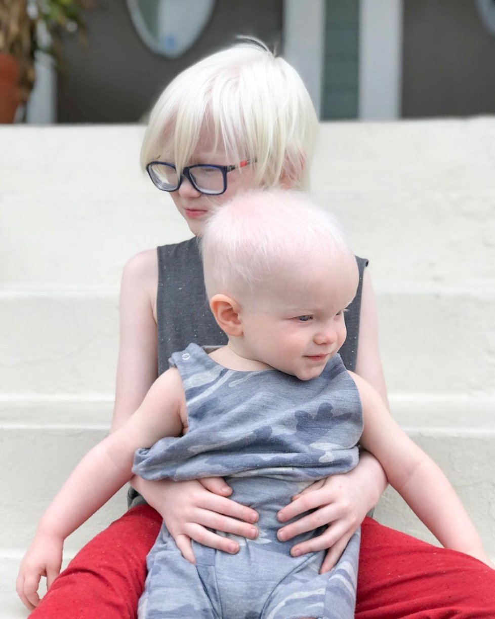 Malý Rockwell se starším bráškou Reddem. Oba jsou albíni.