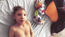 Aničku (3) trpící mikrocefalií chtěli odpojit od přístrojů. Přežila a pečují o ni doma