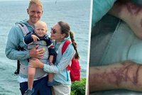 Horor na vysněné rodinné dovolené: Vladimirek (†2) nepřežil žahnutí smrtící medúzy!