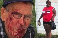 Vrať se do své země, křičela žena na migranta (91) a rozbila mu obličej cihlou