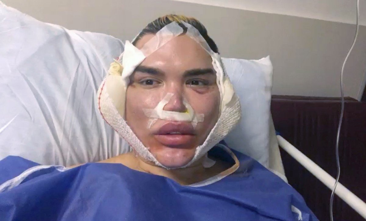 Rodrigo po drastické operaci.