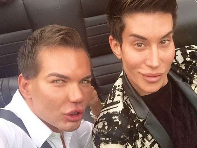 Po dvanácti operacích vypadal Rodrigo Alves jako obživlý plastový panák, ale přesto nebyl se svým vzhledem stále spokojený.