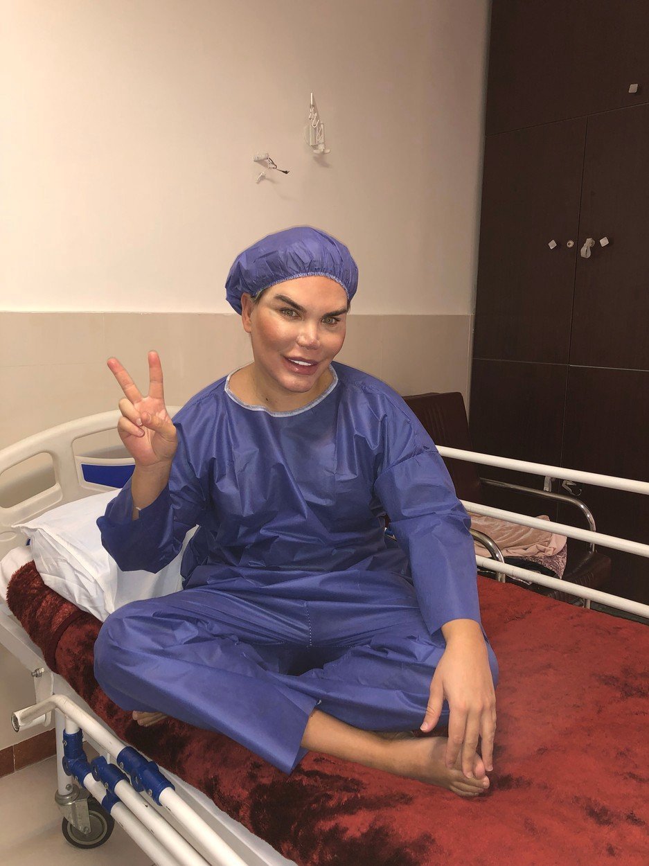 Rodrigo Alves alias živý Ken