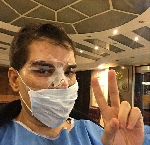 Rodrigo Alves podstoupil několik operací nosu.