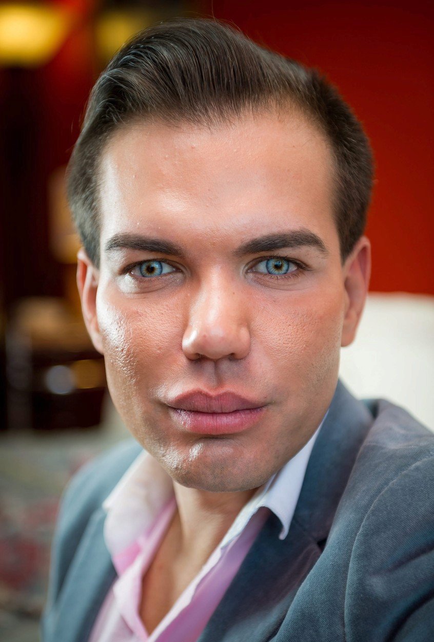 Rodrigo Alves alias živý Ken