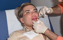 Rodrigo Alves je po 57 plastikách: Ken šel opět na botox!