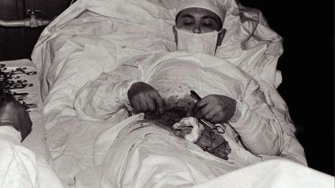 Doktor Rogozov musel operovat sám sebe Doktor Rogozov musel operovat sám sebe