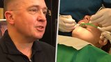 Šmucler radí, jak si najít zubaře. V Česku jich je „hrozně moc“, chybí jen ortodontisté