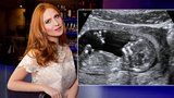 Modelka Pavelková fotila těhotná: Miminko ale pózovat odmítá