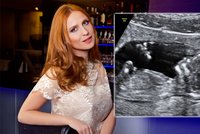 Modelka Pavelková fotila těhotná: Miminko ale pózovat odmítá