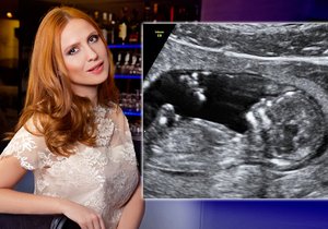 Těhotnou modelku Romanu Pavelkovou netrápily žádné nevolnosti, proto pózovala i s miminkem v bříšku.