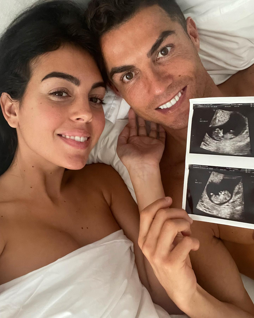 Ronaldo s Georginou přišli o miminko. 