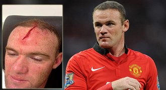 FOTO: Horor! Rooneymu na tréninku rozřízli hlavu a nemůže hrát