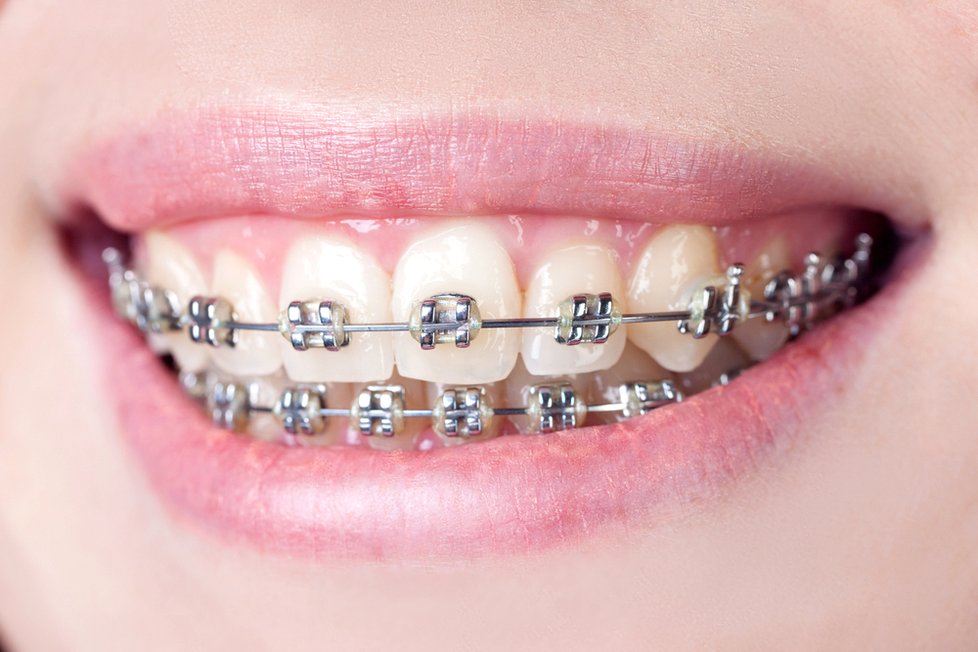 Péči o mléčné zuby se nevyplatí zanedbávat. Ovlivňují i růst trvalého chrupu