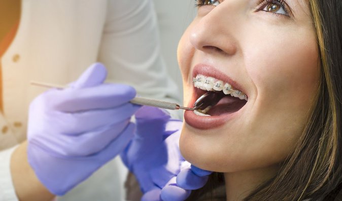 Jaké jsou nové trendy v ortodoncii? A kdy platí rovnátka pojišťovna?