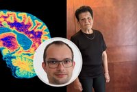 Roky bolesti a nejistoty: Roztroušenou sklerózu Janě odhalili až po 15 letech!