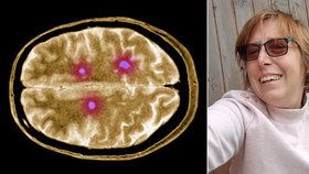 Samoživitelka Štěpánka (41) má roztroušenou sklerózu: Během pandemie nemohla pracovat