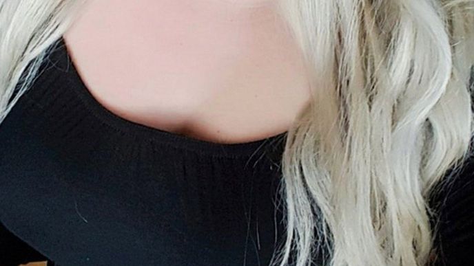 Se svým vzhledem nebyla spokojená. A tak se rozhodla pro zvětšení rtů. Se svým vzhledem nebyla spokojená. A tak se rozhodla pro zvětšení rtů.