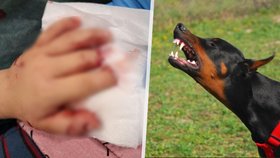 Agresivní pes uhryzl chlapečkovi (2) prsty na ruce.