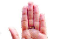 Akupunktura ruky jako prevence proti zimním neduhům: Vymačkejte rýmu z těla!