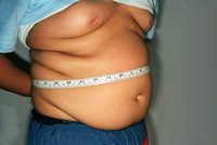 Petr (34) se bál o život, tak raději zhubl 53 kg. Obezita v Česku plíživě zabíjí