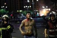 Krvavá demonstrace v Rumunsku: Policie nasadila slzný plyn a vodní děla, 440 zraněných