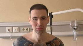 Ruský „Pepek Námořník“ si do svalů píchal vazelínu: Lékaři teď mluví o amputaci ruky!