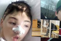 Ivan (15) bránil mámu před znásilněním, skončil v kómatu: Znovu se učí chodit