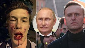 Další Putinův kritik skončil v nemocnici: Opozičního blogera (22) brutálně zbili