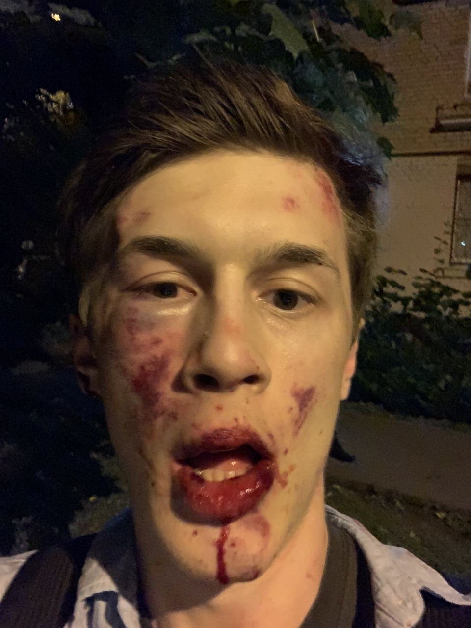 Ruský opoziční bloger Jegor Žukov. Takhle mladík vypadal v den svého napadení v neděli 30. srpna.