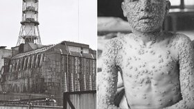 Rusko a jeho tajemství: Antrax svedli na maso, Černobyl zapírali. Teď mlží kolem smrti laborantky (†28)