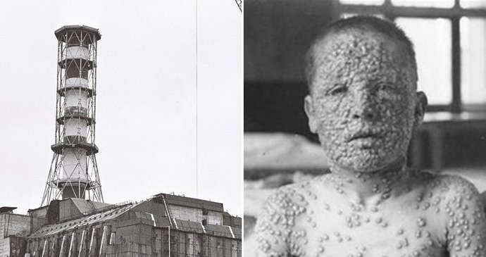 Rusko a jeho tajemství: Antrax svedli na maso, Černobyl zapírali. Teď mlží kolem smrti laborantky (†28)