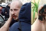 Ukrajinský poslanec ukousl ucho oponentovi při rvačce: Chtěl mu i vydloubnout oči!