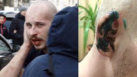 Ukrajinský poslanec ukousl ucho oponentovi při rvačce: Chtěl mu i vydloubnout oči!