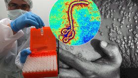 Laboratoří s viry eboly a pravých neštovic otřásl výbuch. „Nehrozí žádné nebezpečí,“ tvrdí Rusové