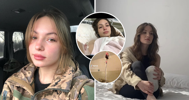 Vojačka Rusja (19) se stala symbolem odporu Ukrajiny: Při ostřelování přišla o nohu!
