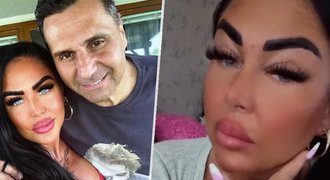 Manželka kouče Růžičky v bolestech: Niťový lifting! Manželka kouče Růžičky v bolestech: Niťový lifting!