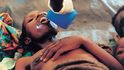 JAN ŠIBÍK, 1994, Goma, Zair.  Ve stanu, který vyrostl v táboře rwandských uprchlíků, ležela stovka lidí s úplavicí a cholerou. Každý den dvacet z nich zemřelo.