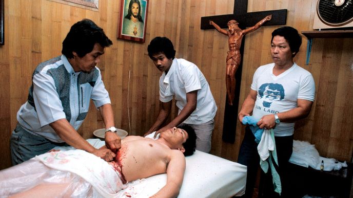 Filipínští léčitelé  tu měli kvůli televizi NOVA skandál před dvaceti lety. Teď přijíždějí další exempláře těchto šarlatánů.