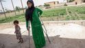 Nejstarší Muhamadova dcera přišla o nohu při výbuchu improvizované nálože na terase vlastního domu, když si hrála se sestrami
