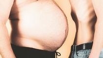 Tlusté Česko: Varovná data o zdravotním stavu národa versus progresivní normalizace obezity