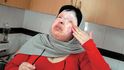 Ameneh Bahrami z Íránu, oslepená kyselinou za to, že odmítla nabídku k sňatku