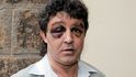 V ROCE 2006 Dolejše nedaleko Poslanecké sněmovny napadli tři muži a surově ho zbili.
