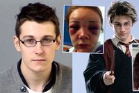 Mladík brutálně zbil dívky, které se mu posmívaly, že vypadá jako Harry Potter: Roky byl šikanován!